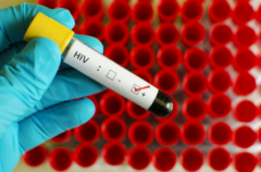 HIV/AIDS – poznaj swój status