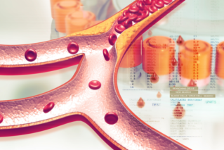 W sieci wiele jest nieprawdziwych informacji o roli cholesterolu LDL