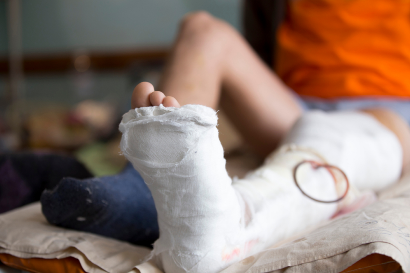 Sąd Okręgowy uznał, że to sama powódka (kobieta, która złamała nogę) w 50% przyczyniła się do swojego wypadku. (fot. Shutterstock)