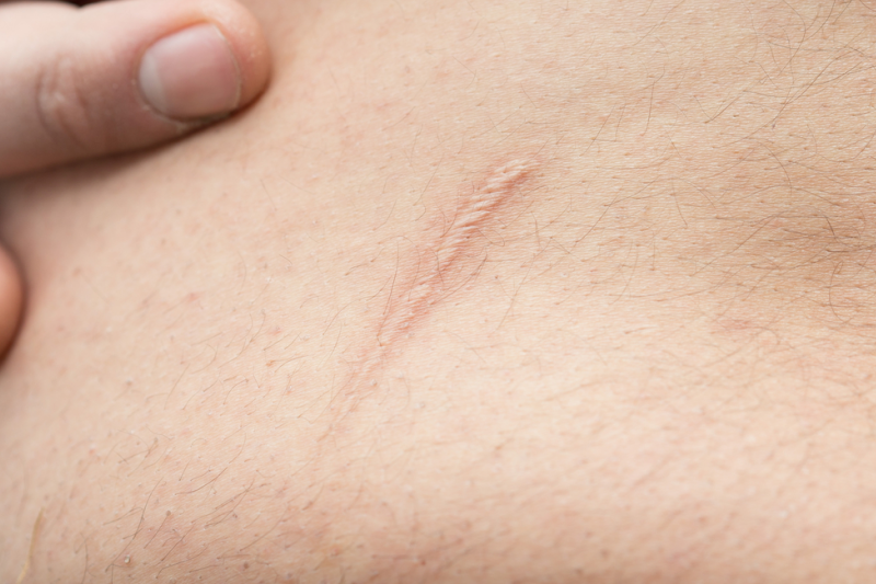 Komórki macierzyste tkanki tłuszczowej wykorzystywane są w medycynie regeneracyjnej, rekonstrukcyjnej, plastycznej oraz w chirurgii. (fot. Shutterstock)