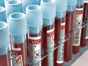 Historia HIV