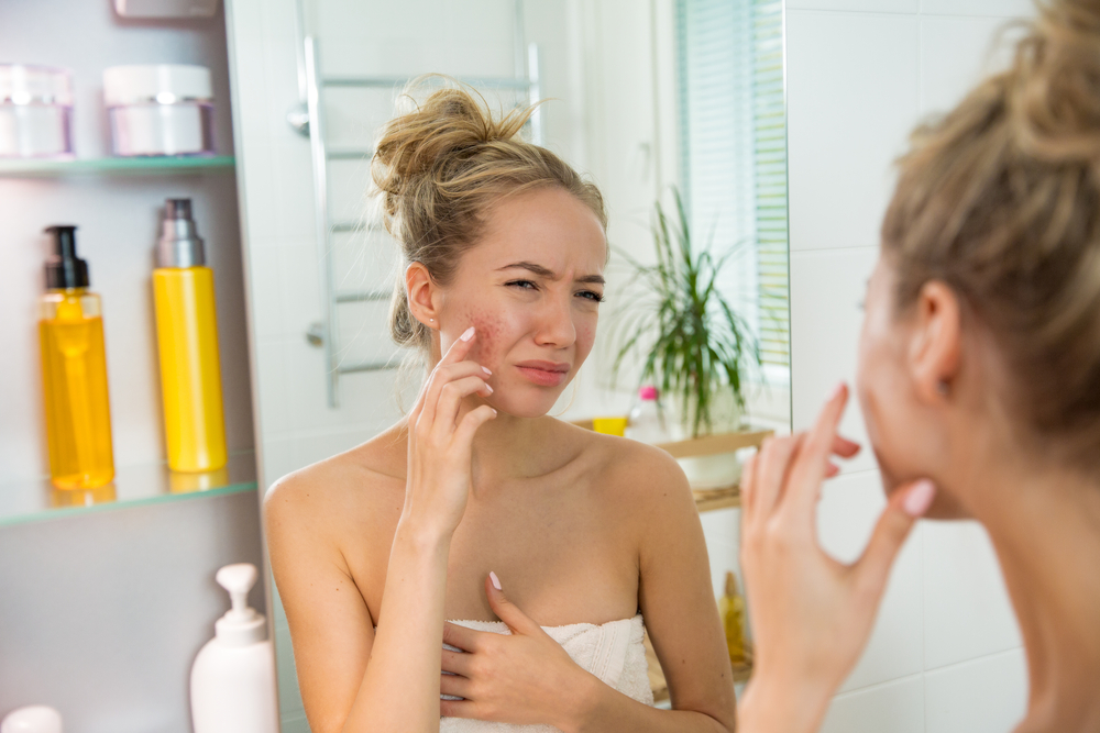 Przebarwieniom skóry łatwiej zapobiegać niż je leczyć (fot. Shutterstock)