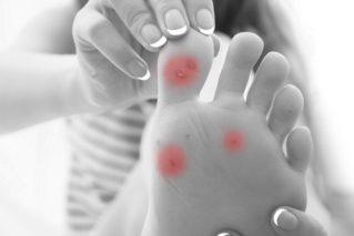 Kurzajki – częsty problem dermatologiczny