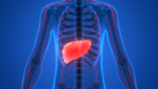 NAFLD. Diagnostyka i obraz kliniczny niealkoholowej stłuszczeniowej choroby wątroby