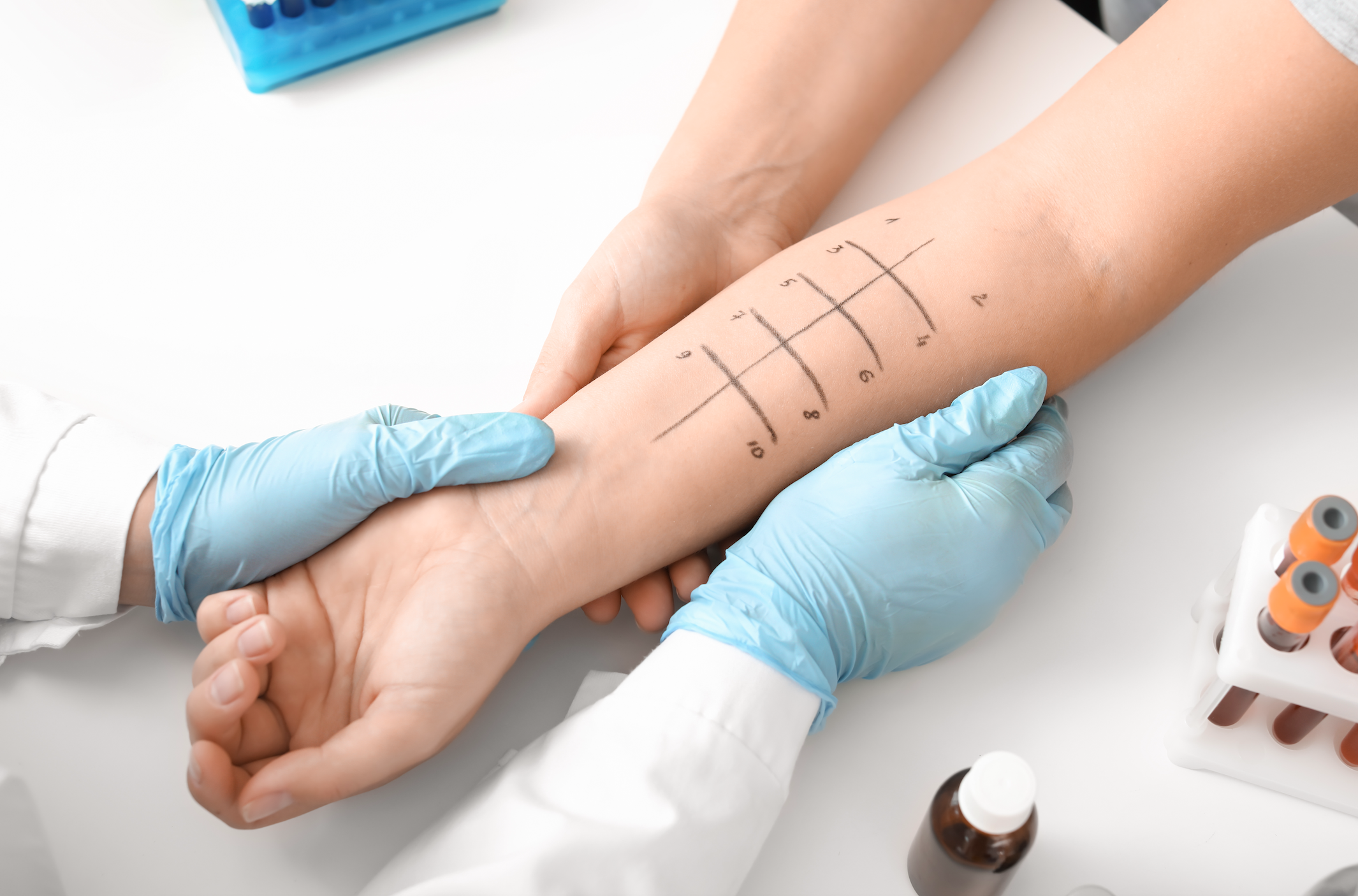 Częstość występowania chorób alergicznych na świecie gwałtownie wzrasta (fot. Shutterstock)