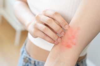 Alergia może przyjmować różne postacie – jakie leki warto wówczas zastosować?
