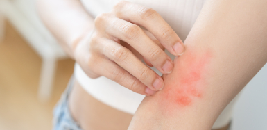 Alergia może przyjmować różne postacie – jakie leki warto wówczas zastosować?