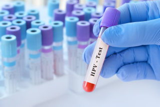 FDA zatwierdza pierwszy samodzielny test na HPV