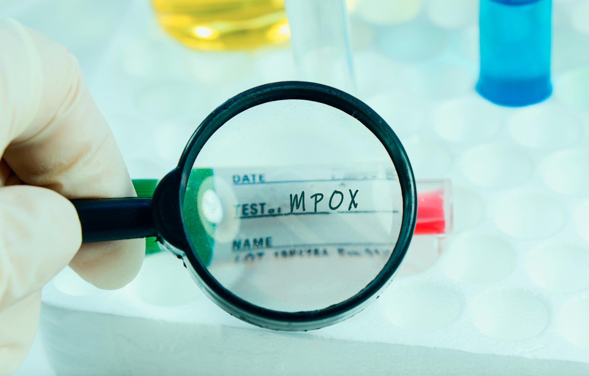 MPOX