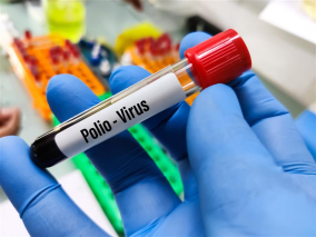Czy w Polsce możemy spodziewać się epidemii polio?