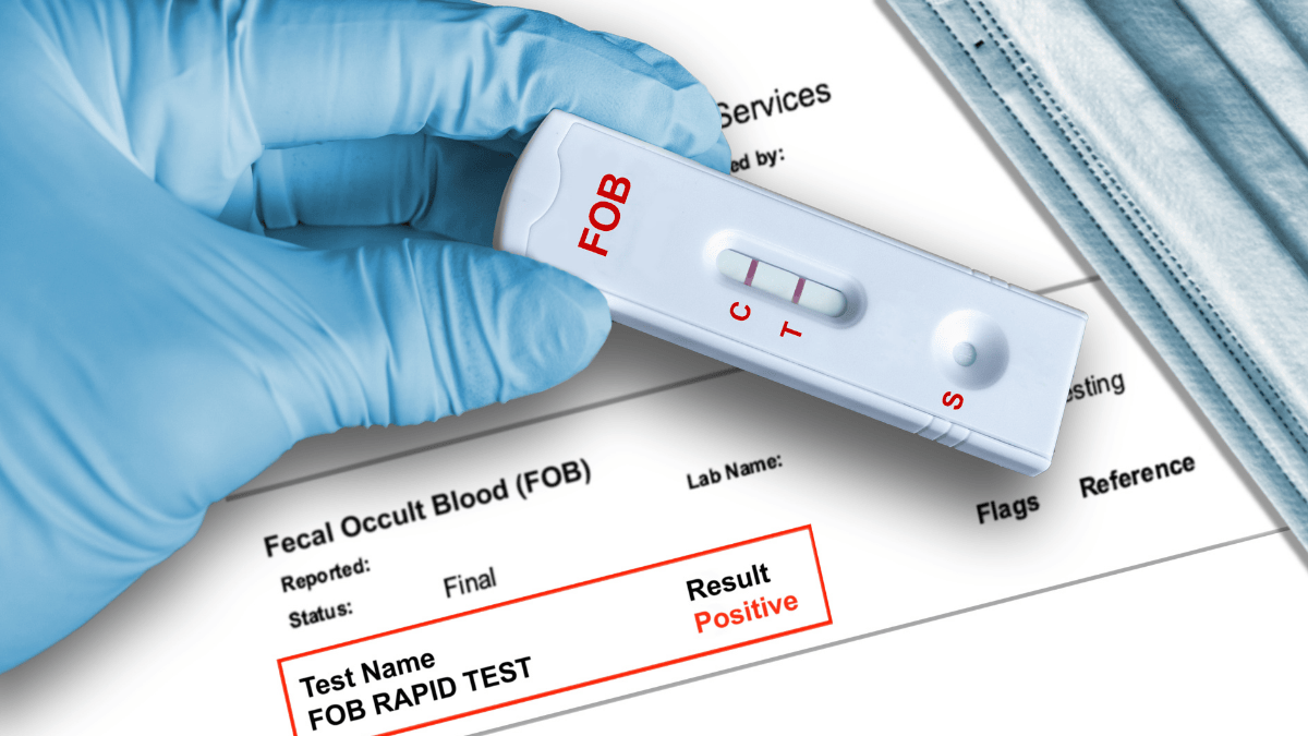 Szybki domowy test na krew utajoną w kale (fot. shutterstock.com)